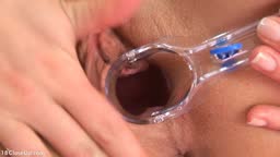 Teen Pussy Closeup Stretched by Speculum