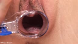 Britney's Pussy Stretched Wide by Speculum