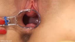 Vagina and Cervix Close Up Examination